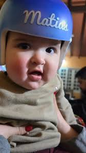 Quiero compartir este hermoso video que preparó la mami de Matías! El fue  diagnosticado con una PLAGIOCEFALIA POSICIONAL SEVERA que requirió el uso  de 2 cascos ortopédicos para alcanzar la corrección ...