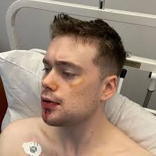 Man left with broken jaw after robbery in Dublin warns 'streets are not  safe'