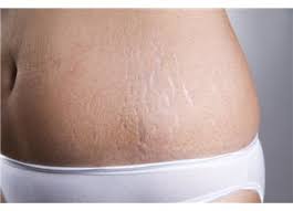 Dogum Catlaklari Nasil Gecer Haberi Makalesi Konulari Guncel Haber Guncel Blog