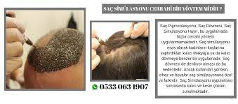 Sac Simulasyonunda Merak Edilenler Hairhotel