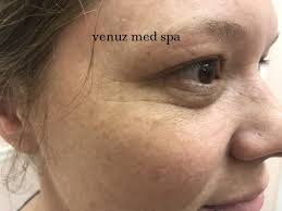 Venuz Med Spa Gallery — Venuz Med Spa