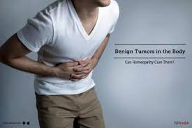 Benign Tumors In The Body Can Homeopathy Cure Them By Dr Mukesh Singh Lybrate