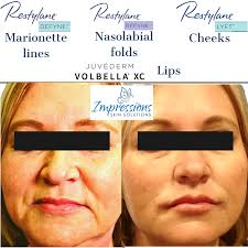 Med Spa in Hendersonville, TN