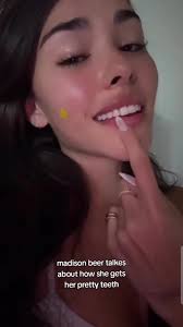 Heather Parisi Teeth