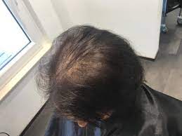 Der bob für ein rundes gesicht. Gl Volume Eine Haarverdichtung Die Neue Massstabe Setzt Friseur Magdeburg