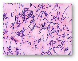 Most species grow only in the complete absence of oxygen. Clostridium Baratii Microbewiki