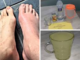 Atau sakit berkaitan lain seperti di bawah? Rawat Sakit Gout Tanpa Ubat Tahan Sakit Hanya Dengan 2 Bahan Ini Maskulin