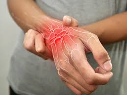 Image result for Rheumatoid Factor