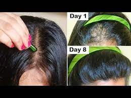 Vitamin E Oil For Double Hair Growth Turn Thin Hair To Thick Hair Get Long Hair Stop Hair Fall Yo Hair Fall Vitamins Hair Growth Oil Thick Hair Remedies