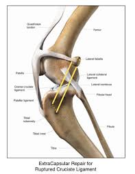 Left leg ligaments / ligaments are bands of tough elastic tissue around your joints. Ruptured Acl In Dogs Valley Animal Hospital Of Merced