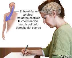Funcion Del Hemisferio Cerebral Izquierdo Medlineplus Enciclopedia Medica Illustracion