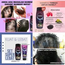 Ada berbagai bahan pengganti sederhana dan alami yang dapat anda gunakan sebagai pengganti shampoo. Shampoo Super Lebat Zs Legacy