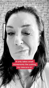 Living with Hemifacial Spasms: My Daily Struggles