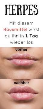 Pin On Ernahrung
