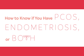 Endometriosis is more common in women who are having fertility issues, but it does not necessarily cause infertility. How To Know If You Have Pcos Or Endometriosis