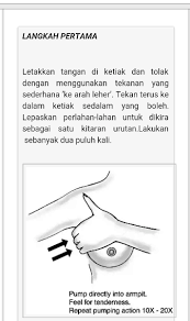 Kamu bisa mengompres mata bengkak dengan susu. Cara Mudah Merawat Bengkak Susu