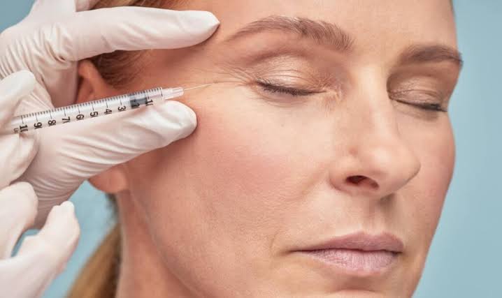 Sunekos Review: A Great Alternative To Botox & Fillers
