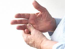 Especially thumb dislocations can appear quite dramatic. Dislocated Finger Symptoms Causes Treatment Recovery And More