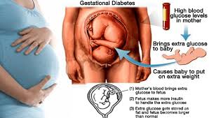 Selain makanan, suplemen juga dibutuhkan oleh ibu hamil agar kebutuhan nutrisinya terpenuhi dengan sempurna. Pemantauan Bsp Sewaktu Ramadhan My Sweet Life Story