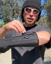 I ended up with a hairline fracture