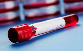 L ump or mass, especially in the abdomen, neck, chest, pelvis, or armpits. Early Signs And Symptoms Of Blood Cancer You Should Not Miss