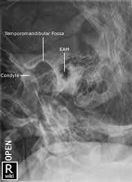 Pin By Jeremy Enfinger On Radiographic Anatomy Radiology Imaging Radiology Schools Medical Knowledge