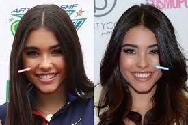 You all also wanted to know about nicola peltz's (possible) plastic surgery. Madison Beer Cosmetic Surgery Boob Job Nose Lip Injections