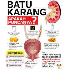 Masa sy sakit batu karang kelmarin. Punca Batu Karang Easy P Solusi Masalah Prostat Facebook
