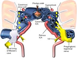 This article discusses each of the aforementioned fossae and their associated foramina. Neuroimaging Of Meckel S Cave In Normal And Disease Conditions Insights Into Imaging Full Text