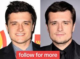 Do Guys in Hollywood Get Surgery