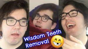 We did not find results for: One Week After Wisdom Teeth Removal Reddit 1 Week After Wisdom Teeth Removal And Still Feel