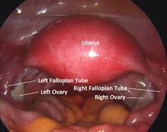 Abdominal and pelvic anatomy encompasses the anatomy of all structures of the abdominal and this anatomy section promotes the use of the terminologia anatomica, the international standard of. Infertility Surgery Dallas Ivf Frisco Dallas Tx