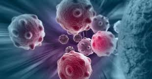 Cancer is the uncontrolled growth of abnormal cells anywhere in a body. Cancer When Good Cells Go Bad Ctca