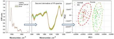 Ftir spectroscopy offers a vast array of analytical opportunities in academic, analytical, qa/qc and forensic labs. Breast Cancer Detection By Atr Ftir Spectroscopy Of Blood Serum And Multivariate Data Analysis Sciencedirect