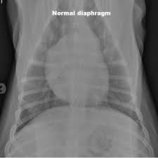 Read on and find out more about cancer in dogs. The Indications For Medical Management Of Splenic Disease