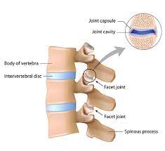 Neck Pain — Causes, Symptoms, & Treatment | Msk Australia