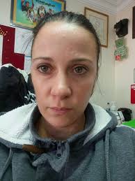 Kikyo Red Speckled didn't do so well.