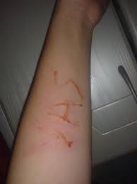 sevgilim ismimi bilegine jiletle kaziyor resimli kizlarsoruyor