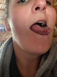 Probable seizure in sleep, no memory of incident