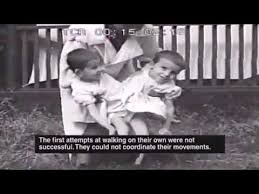 Being a conjoined twin comes with a flurry of physical, mental and emotional challenges. Young Masha And Dasha Attempt To Learn How To Walk Youtube