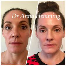 Your health is top priority. Dr Anna Hemming In Twickenham