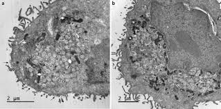Jun 20, 2021 · chemical ingredients that block uv rays do so by absorbing the rays and neutralizing them, so that they cannot render any harm to your skin cells. Ultrastructural Modifications Induced By Sars Cov 2 In Vero Cells A Kinetic Analysis Of Viral Factory Formation Viral Particle Morphogenesis And Virion Release Springerlink