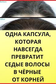 как избавиться от перхоти и выпадения волос в домашних условиях Masky Na Tvar Krk Dekolt V 2020 G Recepty Dlya Rosta Volos Lekarstva Dlya Volos Lechenie Vypadeniya Volos