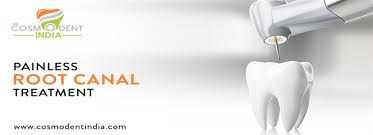 How long does it take to complete a root canal? Painless Root Canal Treatment In Bangalore