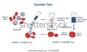 Image result for Direct Coombs