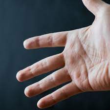 Jadi, jangan diabaikan apabila anda sering mengalami kebas pada kaki atau tangan. Tangan Terasa Dingin Awas Sindrom Raynaud