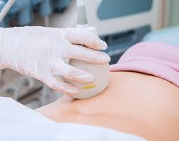 A special ultrasound, called a nuchal translucency screening, measures the back of the baby's neck. Nuchal Translucency Test