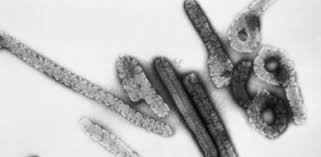 La enfermedad que produce una fiebre hemorrágica viral de la misma categoría que la fiebre de marburg, la fiebre de lassa y la fiebre del dengue. Mxqk191n29ysom