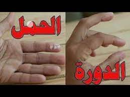 شكل إفرازات الدورة بالصور