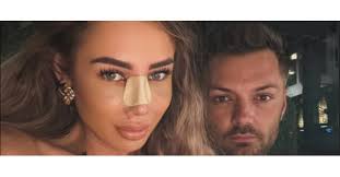 Maria Avram, primele imagini după operația la nas. Fosta concurentă de la  Insula Iubirii a explicat